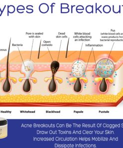 Mayur Naturals Detox Dead Sea Clay And Neem Mask 8 91dMFIZj35L