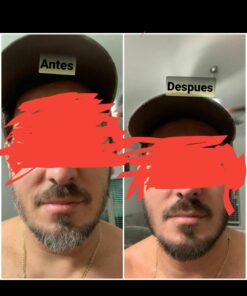 Just For Men Mustache & Beard, Beard Dye for Men with Brush Included for Easy Application, With Biotin Aloe and Coconut Oil for Healthy Facial Hair - Dark Brown, M-45, Pack of 3 19 91fja2TCZWL