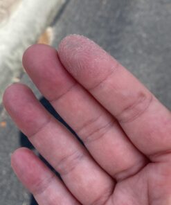 Warticide Fast-Acting Wart Remover - Plantar and Genital Wart Removal, Attacks Warts On Contact, Easy Application (1 Fluid Ounce) 1 Fl Oz (Pack of 1) 30 91hWHxc5P L