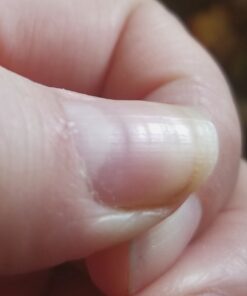 SmartyPants Women's Formula Gummy Vitamins: Gluten Free, Multivitamin, CoQ10, Folate (Methylfolate), Vitamin K2, Vitamin D3, Biotin, B12, Omega 3 DHA/EPA Fish Oil, 180 count (30 Day Supply) Womens Multi 180 Count (Pack of 1) 39 91jbHU2ZKxL