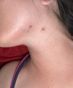 Warticide Fast-Acting Wart Remover - Plantar and Genital Wart Removal, Attacks Warts On Contact, Easy Application (1 Fluid Ounce) 1 Fl Oz (Pack of 1) 28 91k0FFRhk7L