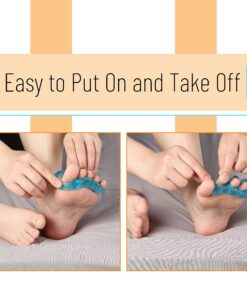 DR. JK- ToePal Gel Toe Separator, 2 Pairs, Toe Spacers, Toe Straightener, Hammer Toe Straightener, Toe Spreader, Toe Stretcher, Toe Corrector for Women and Men, Bunion Corrector Blue 22 91kcBzIjlBL