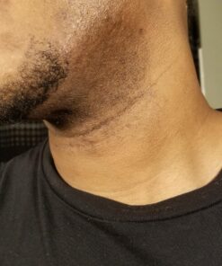 Tend Skin Razor Bump Solution, 4 ounce, Post Shaving & Waxing, for women & men 49 91wdOJkEuiL