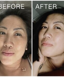 Warticide Fast-Acting Wart Remover - Plantar and Genital Wart Removal, Attacks Warts On Contact, Easy Application (1 Fluid Ounce) 1 Fl Oz (Pack of 1) 29 91wovsWIAoL