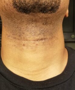 Tend Skin Razor Bump Solution, 4 ounce, Post Shaving & Waxing, for women & men 50 91wpGOapGML