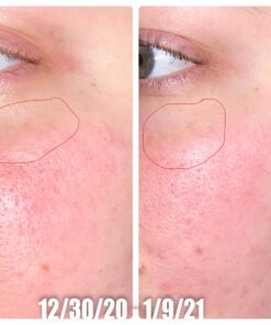 DearKlairs Freshly Juiced Vitamin Drop, 5% Hypoallergenic pure vitamin C serum, 1.18oz | ascorbic acid vitamin c serum, antioxidant serum for face, korean skincare 39 91xooiqLXyL