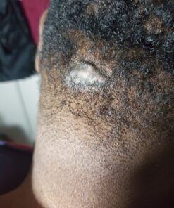 iSerra 250,000 SPU Serrapeptase Enzyme - 90 Maximum Strength Capsules - Up to 12x More Potent Than Other Serrapaptase - Delayed Release Technology-High Potency Non-GMO, Gluten Free, Vegan (Pack of 1) 90 Count (Pack of 1) 23 91yLsR5wEtL