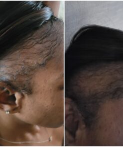 DrFormulas HairOmega 3-in-1 Hair Growth Vitamins with DHT Blocker, Biotin for Women & Men | Hair Skin and Nails Supplement for Hair Loss, 120 Pills 120 Count (Pack of 1) 34 91yoyi6UbxL