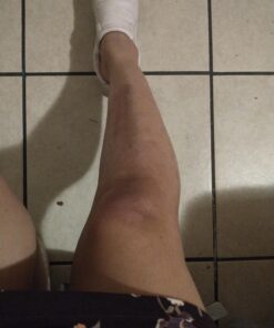 Medline Remedy Olivamine Clear-aid Skin Protectant, 2.5 Ounce 10 A13x LLeQL