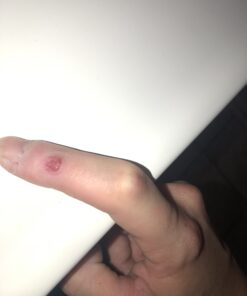 Dr. Scholl's Clear Away WART Remover HYDROGEL Bandage // 12 Discs/9 Cushions, Clinically Proven, Immediate & All-Day Cushioning Pain Relief, Multi-Day Coverage, 12 Treatments 33 A1SecSfwMbL