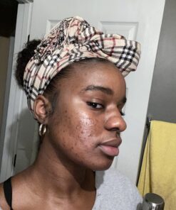 Sky Organics African Black Soap Bar for Body to Cleanse, Soothe & Refresh, 16 Oz 1 Pound (Pack of 1) 53 B14D34f rS