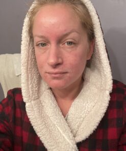 Silver Miracles Colloidal Silver Gel - Nano Silver Gel Wound Care - Healing Ointment for Burns, Sunburns & Irritated Skin - 4 Oz Unscented 42 B18PMcuCI6S