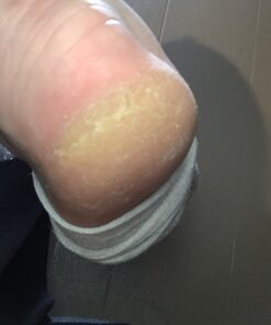 Kerasal Intensive Foot Repair, Skin Healing Ointment for Cracked Heels and Dry Feet, 1 Oz 43 B1GXMJabPJS