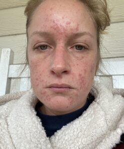 Silver Miracles Colloidal Silver Gel - Nano Silver Gel Wound Care - Healing Ointment for Burns, Sunburns & Irritated Skin - 4 Oz Unscented 43 B1HWSht2cJS