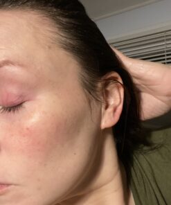 VoilaVe Vitamin C Serum For Face with Hyaluronic Acid | Brightening & Hydrating Serum | Remove Fine Lines Wrinkles & Anti-Aging Serum | Helps to Rebuild Collagen | Airless Pump | As Seen On TV- 1 Oz 35 B1ML4Tak 7S