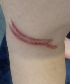 Structured Colloidal Silver Gel for Burns and Wounds - Cooling Silver Extra Strength 35ppm Silver Gel 29 B1mNiTKYF8S