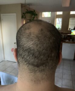 CLn® Shampoo - Clarifying Formula with Salicylic Acid, For Normal to Oily Scalp Prone to Folliculitis, Dandruff, Itchy & Flaky Scalp, Fragrance-Free & Paraben-Free, 8 fl. oz. 8 Fl Oz (Pack of 1) 26 B1x3sI4yIJS