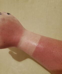 Organic Aloe Vera Gel - 100% Pure for Skin, Sunburn Relief & Face Moisturizer - Extracted from Aloe Vera Plant with Manuka Honey, Orchid & Apple Stem Cells - Everyday Use - 8 Fl Oz 8 Fl Oz (Pack of 1) 34 C1LEsQFUMS