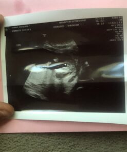 GenderBliss® Gender Prediction Test Kit - Early Pregnancy Boy or Girl Gender Reveal Home Test - Non-invasive Safe for Mother and Baby. Find out your babies gender as early as 10 weeks! 35 C1TFOcjUIES