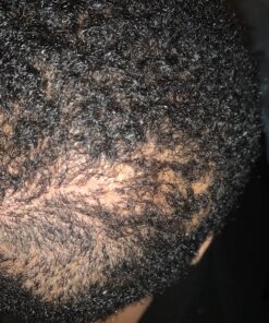 Organic Aloe Vera Gel - 100% Pure for Skin, Sunburn Relief & Face Moisturizer - Extracted from Aloe Vera Plant with Manuka Honey, Orchid & Apple Stem Cells - Everyday Use - 8 Fl Oz 8 Fl Oz (Pack of 1) 31 C1apa La5QS