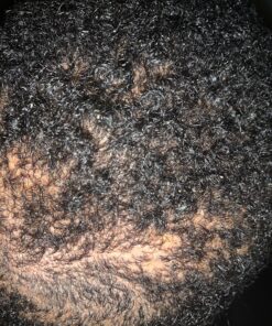 Organic Aloe Vera Gel - 100% Pure for Skin, Sunburn Relief & Face Moisturizer - Extracted from Aloe Vera Plant with Manuka Honey, Orchid & Apple Stem Cells - Everyday Use - 8 Fl Oz 8 Fl Oz (Pack of 1) 32 C1g7qFhM pS