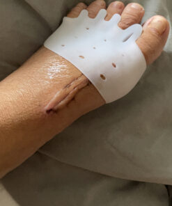 Ball of Foot Cushions, (4PCS) Metatarsal Pads, Toe Separator, Toe Spacers, Breathable & Soft Gel Foot Pads, Forefoot Pads for Mortons Neuroma Callus, Diabetic Feet, Blisters, White 2 Pair (Pack of 1) 29 C1qwJU17EXS