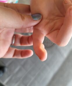 Structured Colloidal Silver Gel for Burns and Wounds - Cooling Silver Extra Strength 35ppm Silver Gel 28 C1sUcN8l3JS