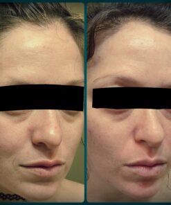 DERMAL 16 Combo Pack A Collagen Essence Korean Face Mask - Hydrating & Soothing Facial Mask with Panthenol - Hypoallergenic Self Care Sheet Mask for All Skin Types - Natural Home Spa Treatment Masks 16 Count (Pack of 1) Set A 16 Colors 55 D1k67sUNuKS